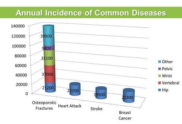 osteoporosis_prevalence_600px